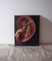 人体解剖模型 coupe de rein 腎臓