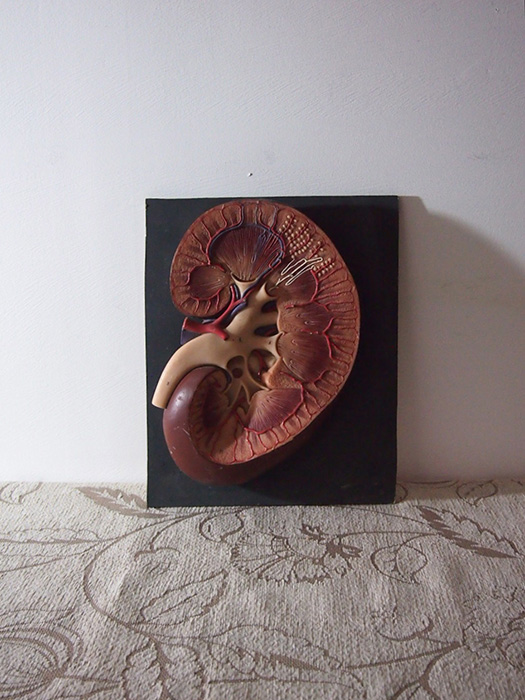 人体解剖模型 coupe de rein 腎臓