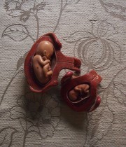 人体解剖模型　fœtus 胎児