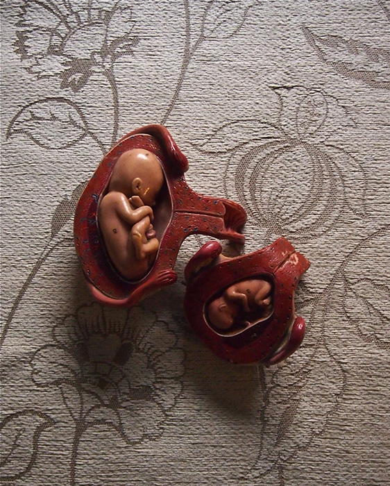 人体解剖模型 Procédé de croissance du foetus 胎児成長過程　