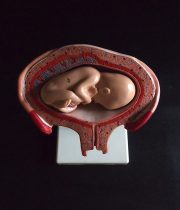 胎児の発育過程模型 4. Monat