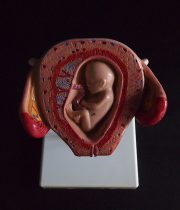 胎児の発育過程模型 3. Monat