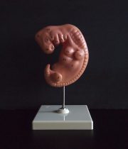 胎児の発育過程模型 4. Woche