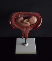 胎児の発育過程模型 5. Monat