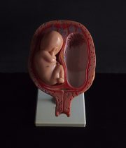 胎児の発育過程模型 5. Monat  Twin