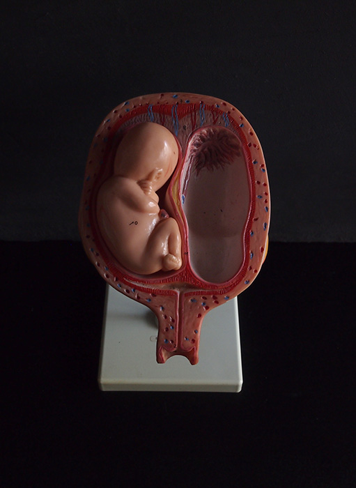 胎児の発育過程模型 5. Monat  Twin