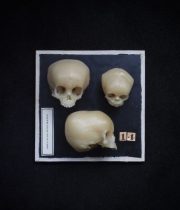 頭蓋骨のワックス模型