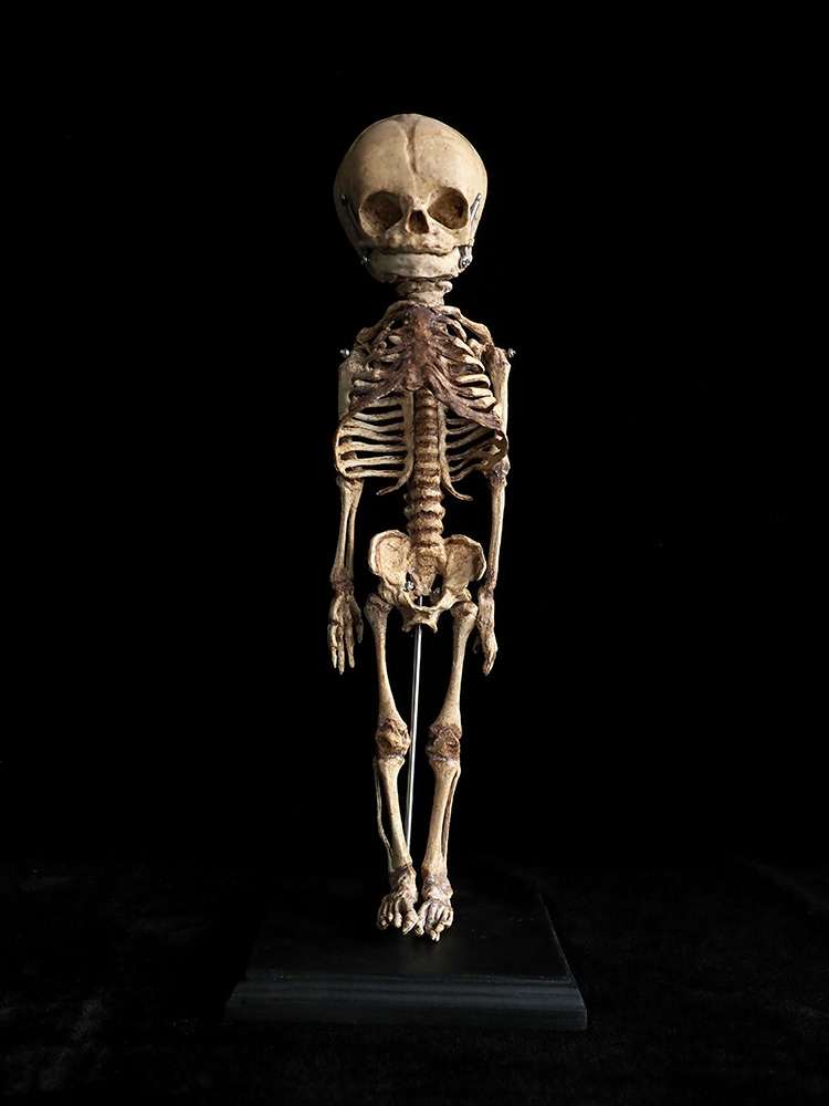 胎児の全身骨格模型